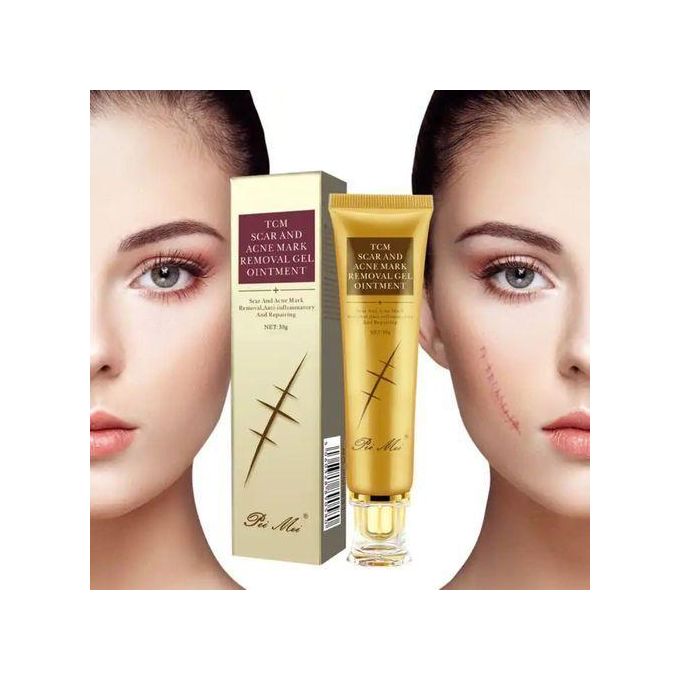 Pei Mei TCM Scar And Acne Mark Removal Gel Ointment Repairing