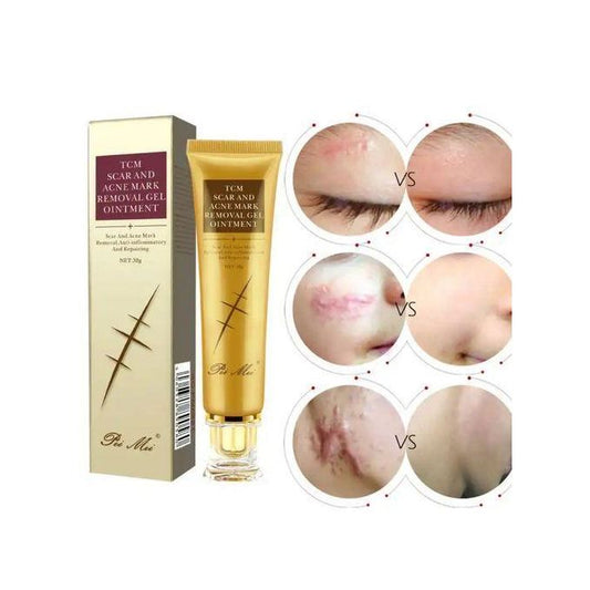 Pei Mei TCM Scar And Acne Mark Removal Gel Ointment Repairing
