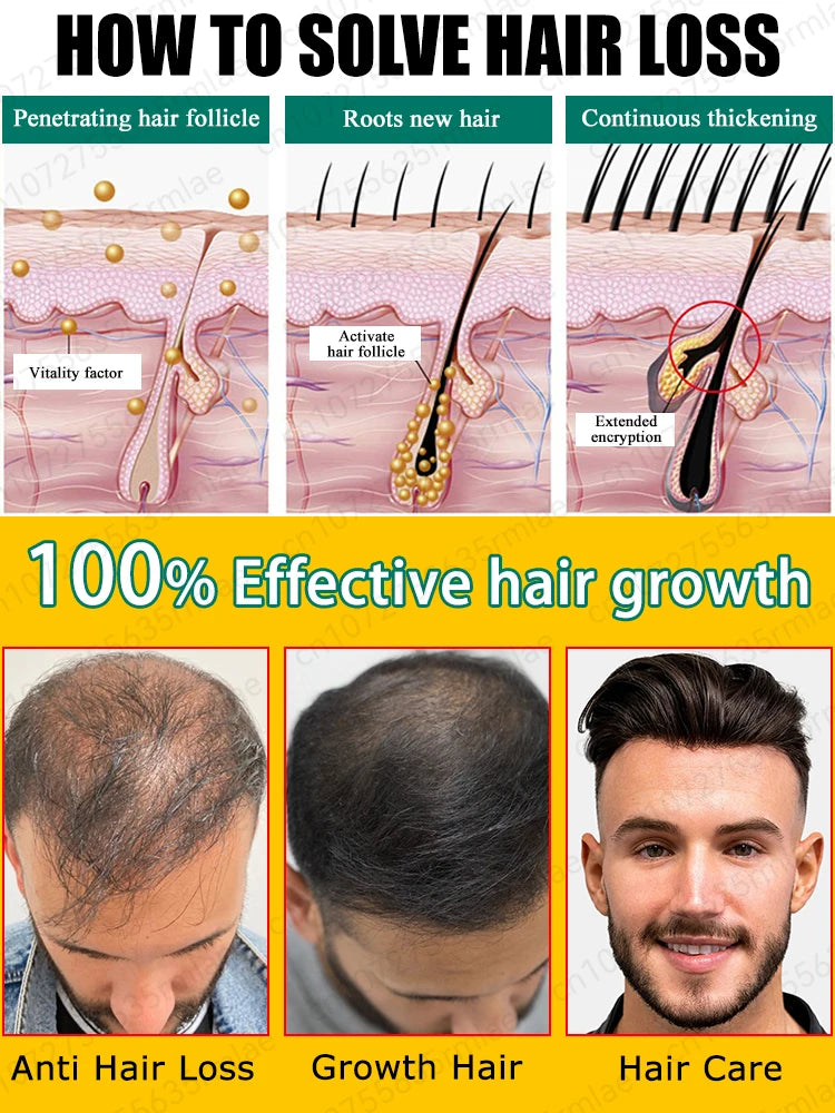 Experts have certified the most effective hair growth product, say goodbye to baldness in 7 days. Also effective for beard, ches