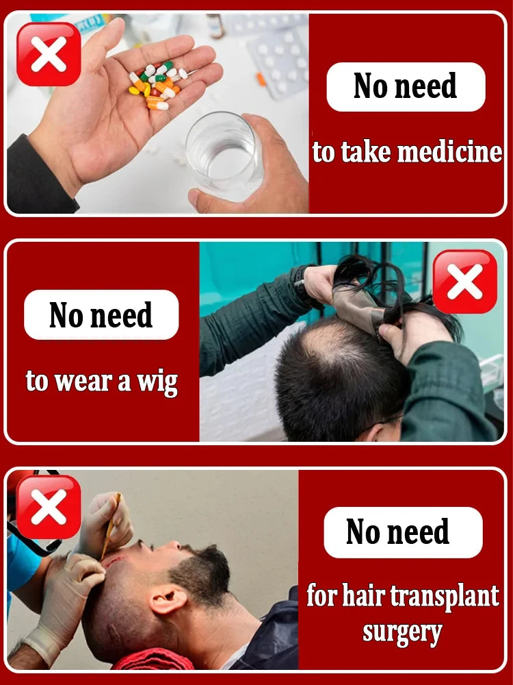 Experts have certified the most effective hair growth product, say goodbye to baldness in 7 days. Also effective for beard, ches