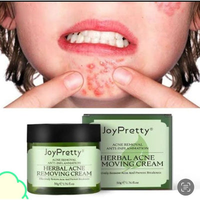 Joy JoyPretty Herbal Day Cream For Acne Skin Care